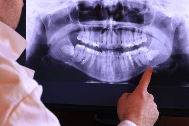 Best Emergency Root Canal Treatment in Hickory Creek, TX