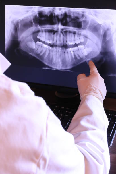 Best Emergency Tooth Extraction in Hickory Creek, TX