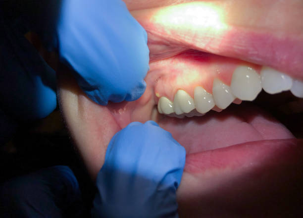 Best Emergency Treatment for Toothache in Hickory Creek, TX