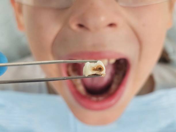 Best Same-Day Emergency Dentist in Hickory Creek, TX
