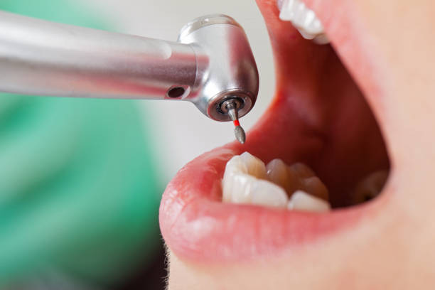 Best Emergency Dental Care for Trauma or Injury in Hickory Creek, TX